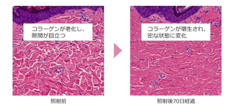 照射前と照射後のコラーゲンの様子