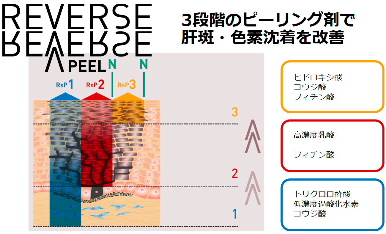 リバースピールの仕組み
