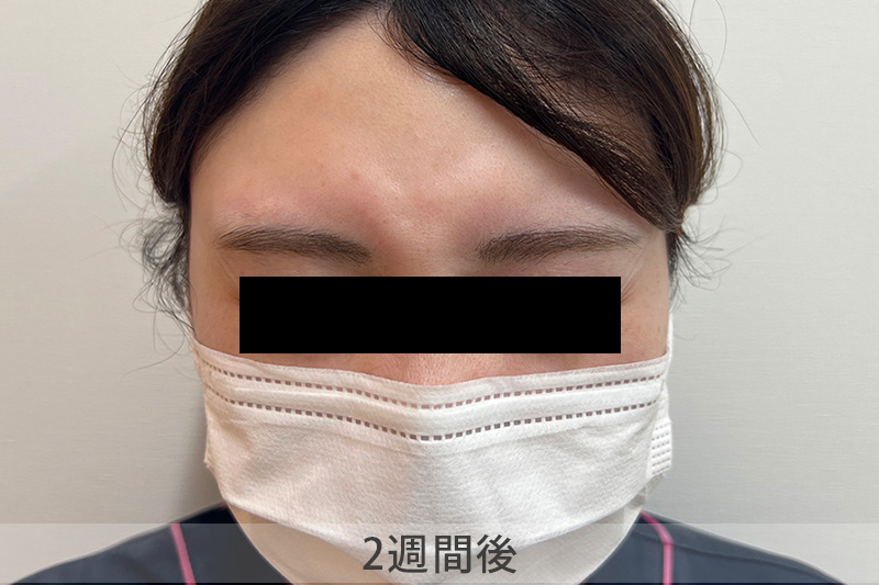 症例3アフター