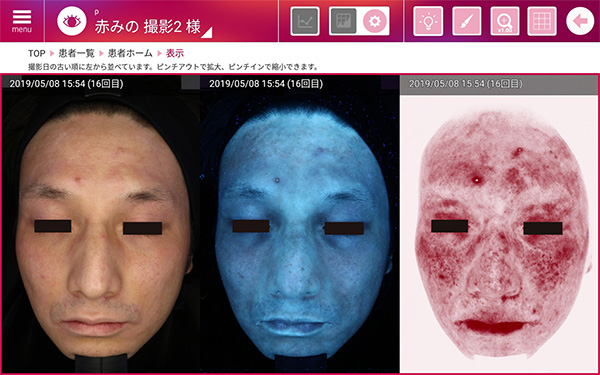 お肌の変化を記録・比較